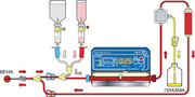 аппаратный фильтрационный мембранный плазмаферез